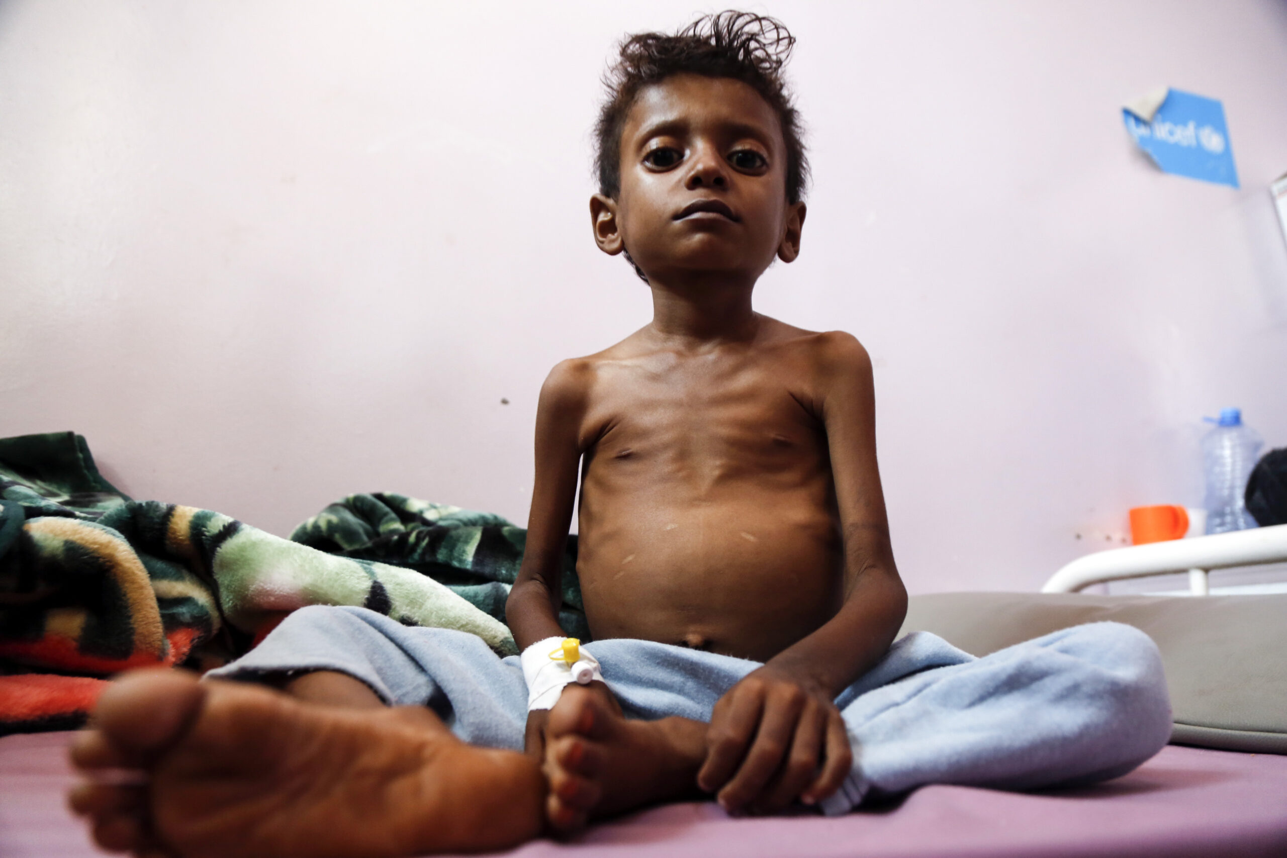 UN calls for urgent action to avert deepening food crisis in South Sudan