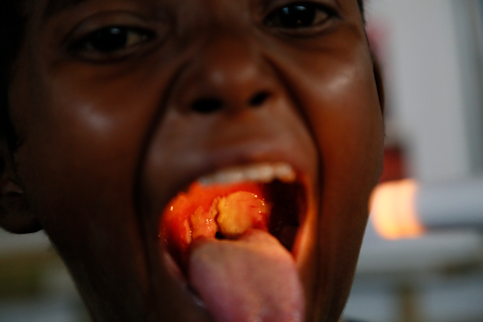 Mauritania reports 15 deaths as diphtheria spreads in SE regions