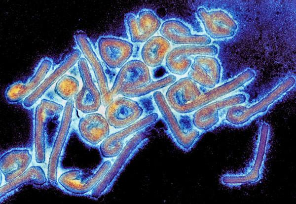 Ethiopia reports six deaths in Marburg virus outbreak