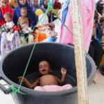 Somalia faces severe malnutrition crisis as WFP warns of aid halt